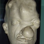 story of syphillis