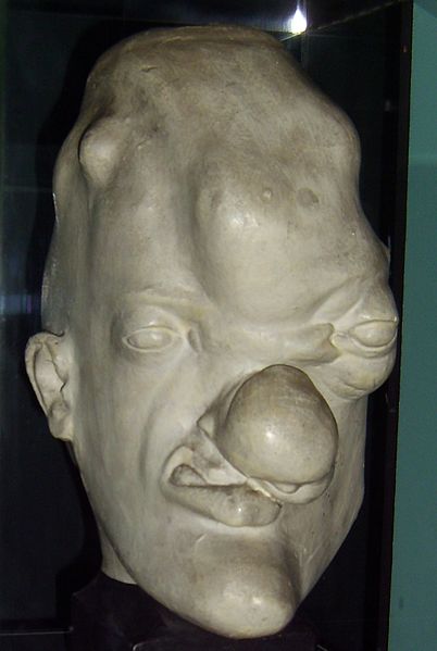 story of syphillis
